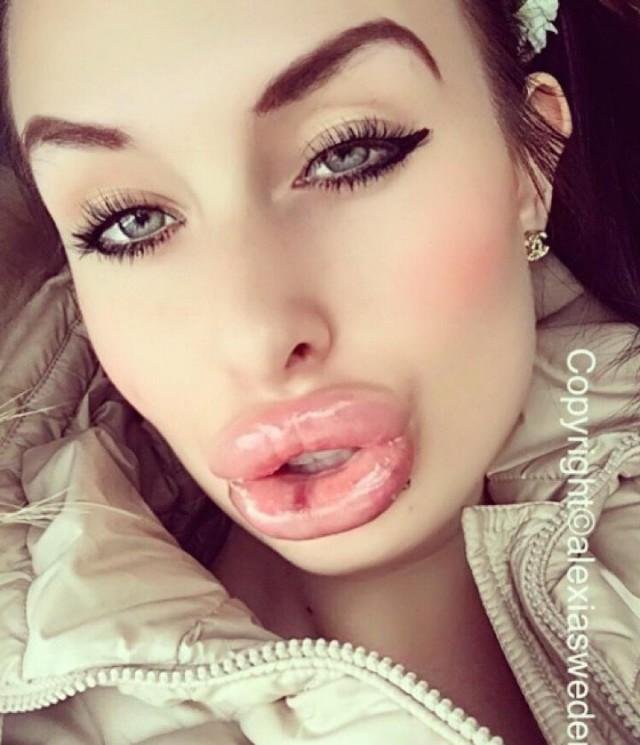 Big lips white girl