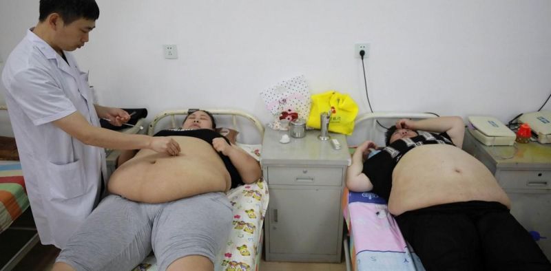 Как лечат ожирение в Китае