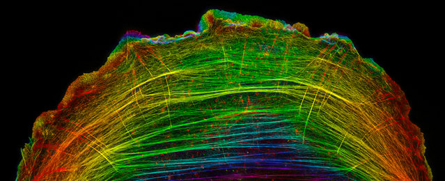 Фото под микроскопом Nikon Small World 2014