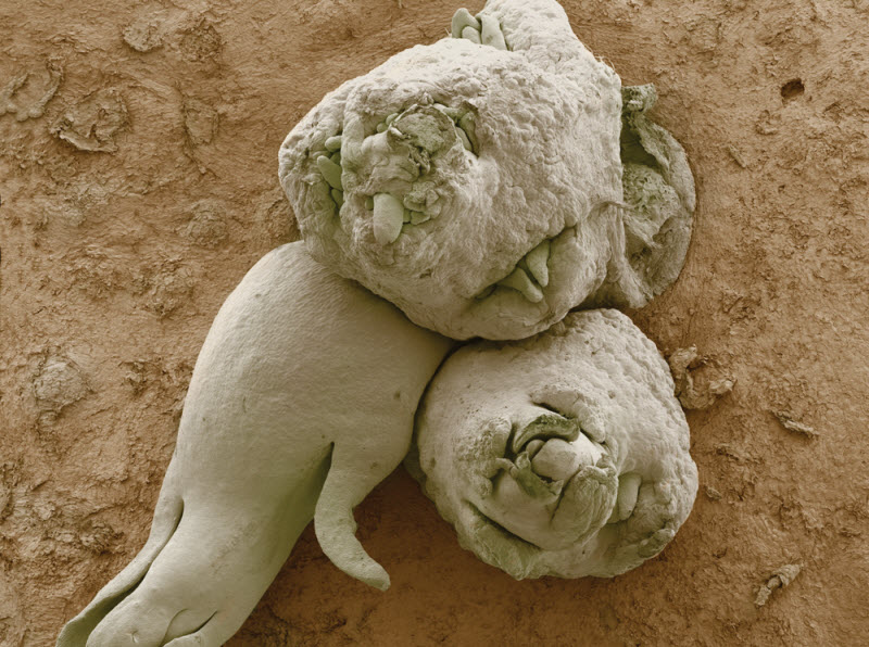 Фрукты и овощи под микроскопом