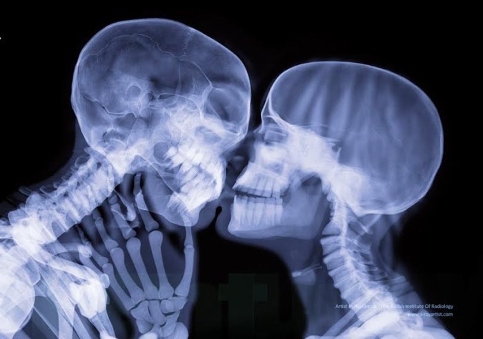 Люди в рентгеновских лучах от Хью Тёрви