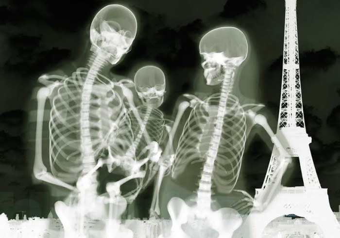 Люди в рентгеновских лучах от Хью Тёрви