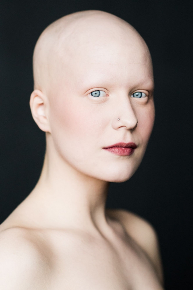 Проект Baldvin — красота облысения от исландского фотографа