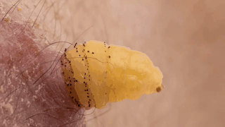 Подборка гифок с насекомыми и паразитами