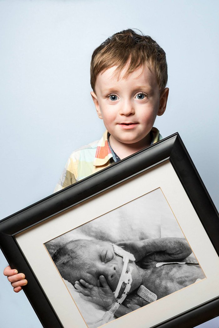 Недоношенные младенцы тогда и сейчас на фотографиях Реда Мето