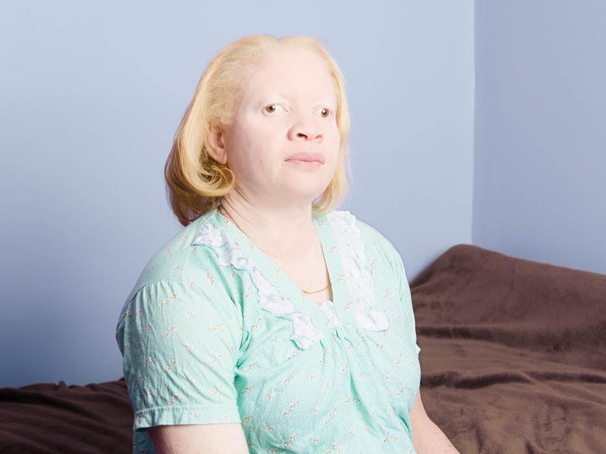 Люди-альбиносы в объективе Анджелины Д`Огаст