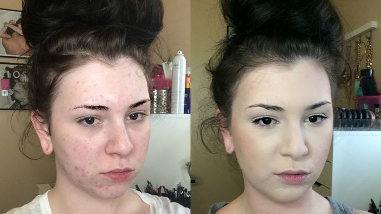 Проблемы с кожей лица и магия макияжа