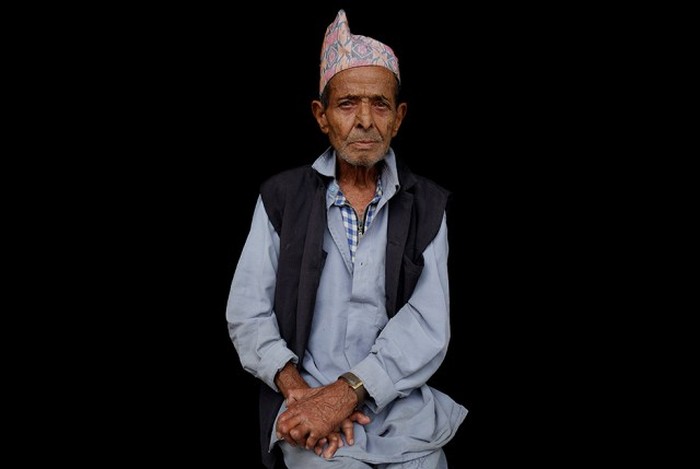 Жители колонии прокаженных в Непале