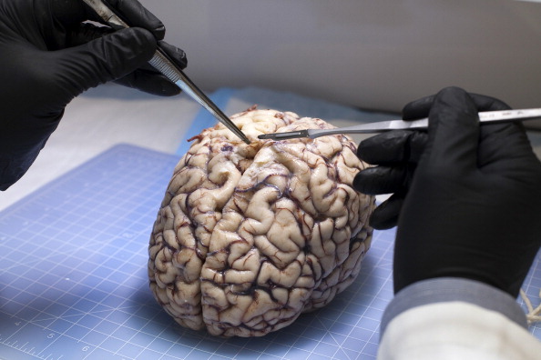 26 фактов о невероятно мощном человеческом мозге