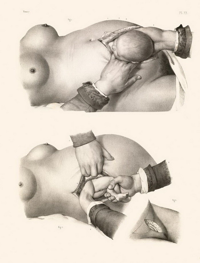 Анатомия XIX века в книге Ричарда Барнетта