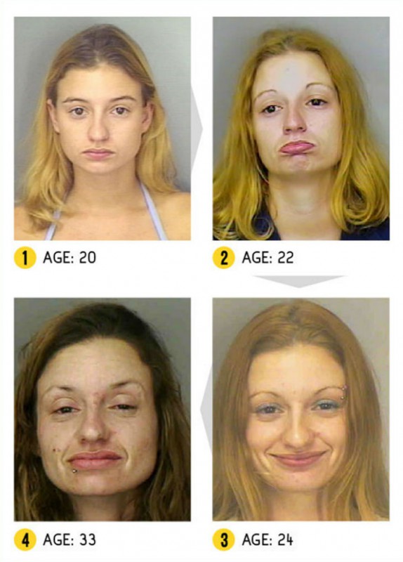 Результат налицо — как меняется внешность человека из-за наркотиков