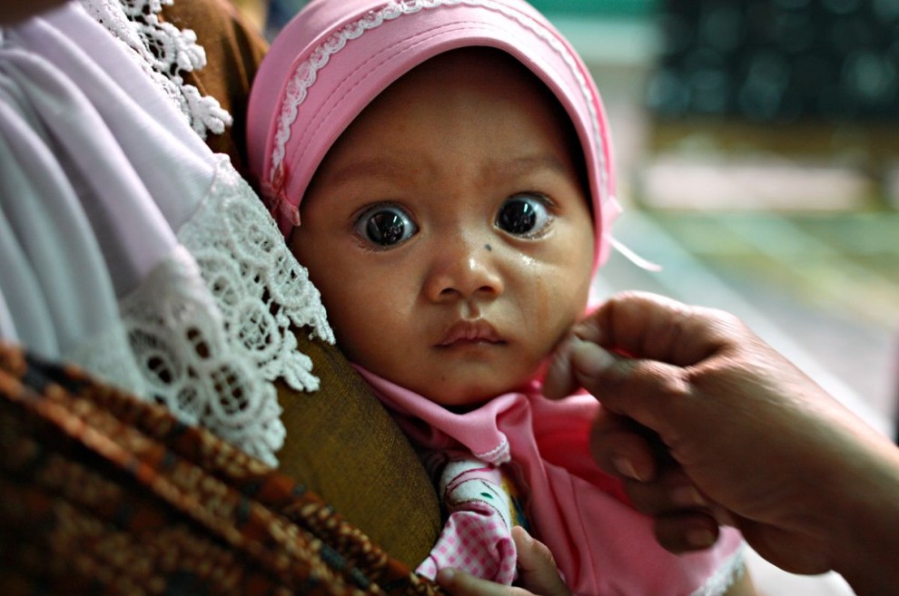 Женское обрезание в Индонезии