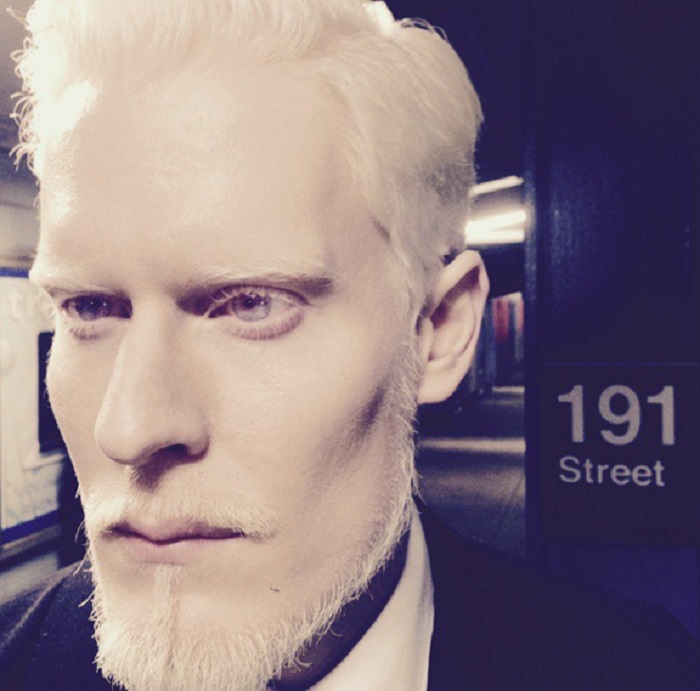 14 успешных моделей-альбиносов