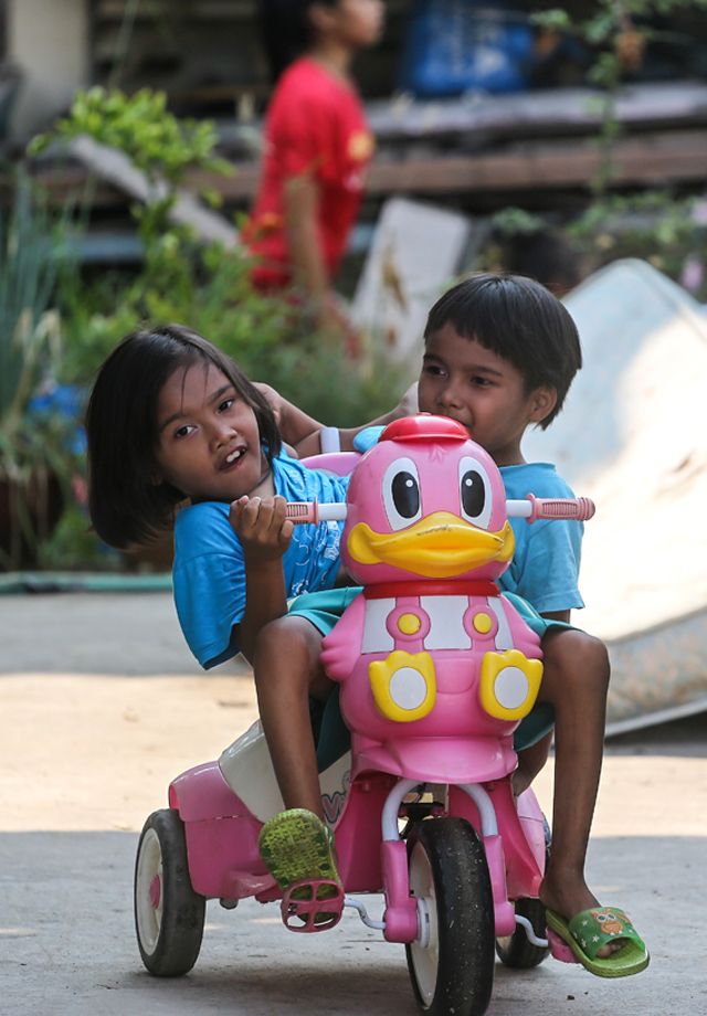 Сиамские сестры-близнецы из Таиланда не хотят, чтобы их разделяли