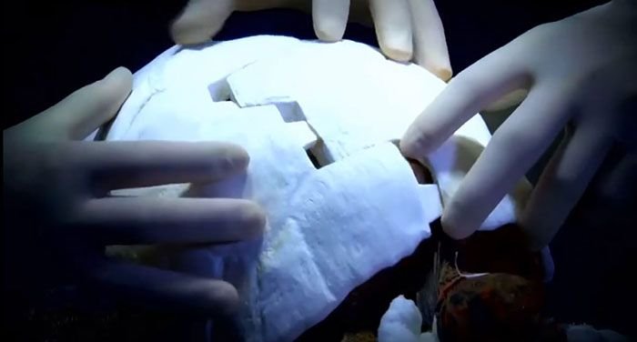 Черепаха получила напечатанный на 3D-принтере новый панцирь