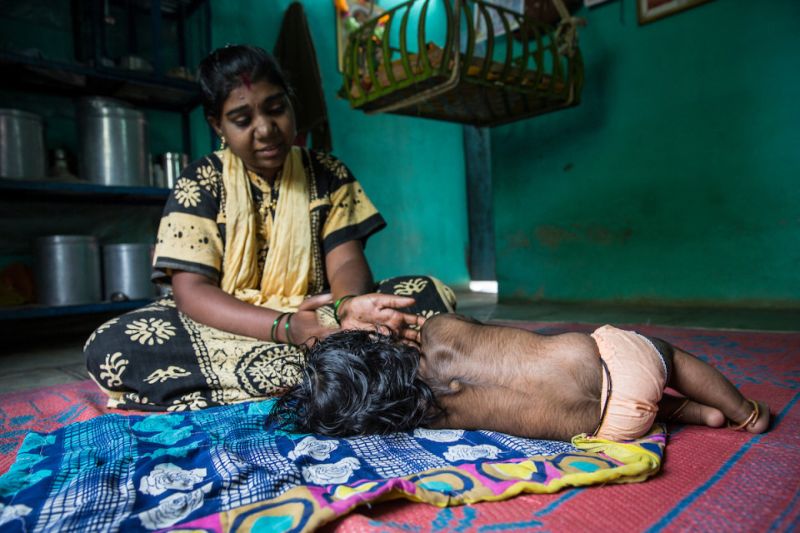 В индийской семье оборотней появился еще один волосатик