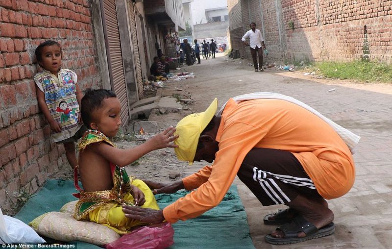Индийцы поклоняются мальчику с дефектом черепа