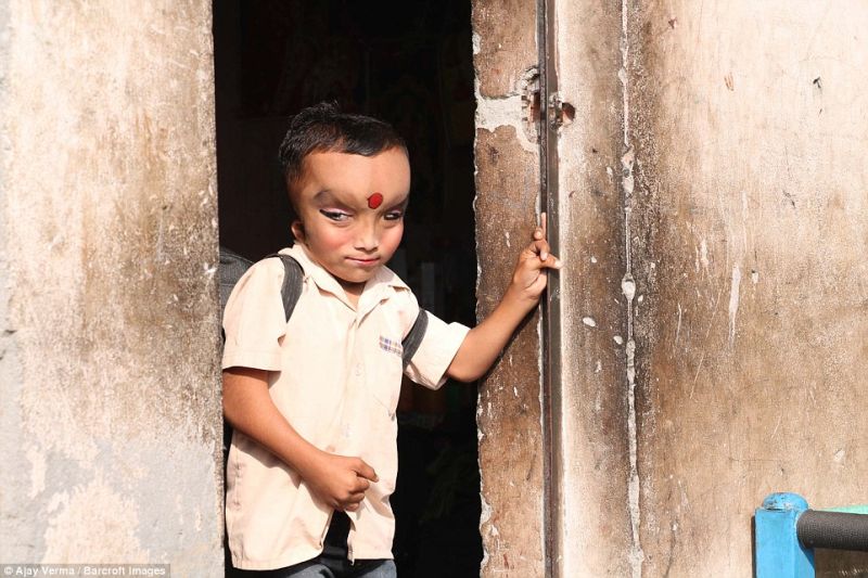 Индийцы поклоняются мальчику с дефектом черепа