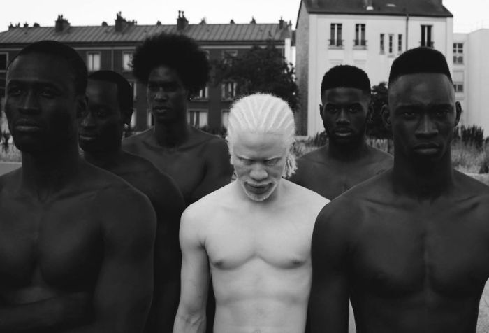 Необычная красота людей-альбиносов