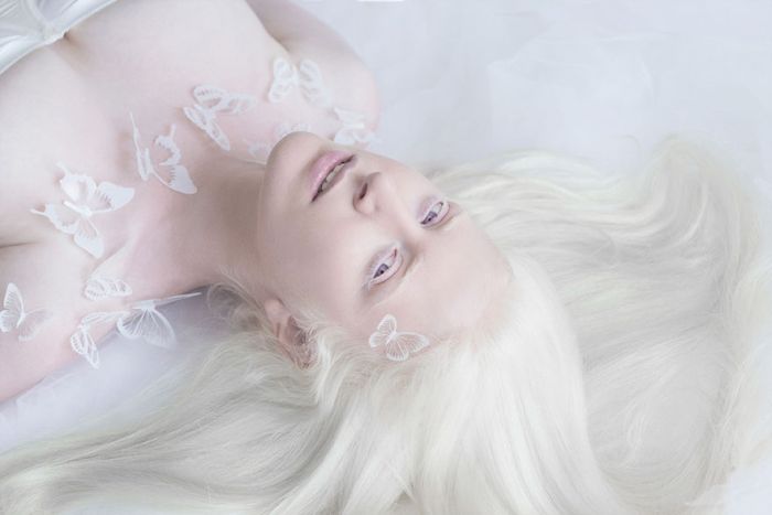 Необычная красота людей-альбиносов
