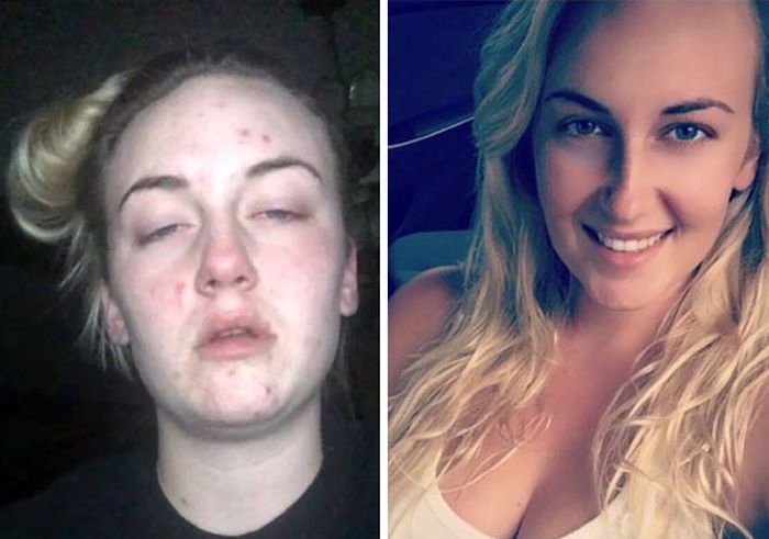 Преображения бывших наркоманов: до и после