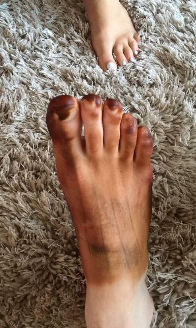 Жена использовала носок мужа для нанесения искусственного загара