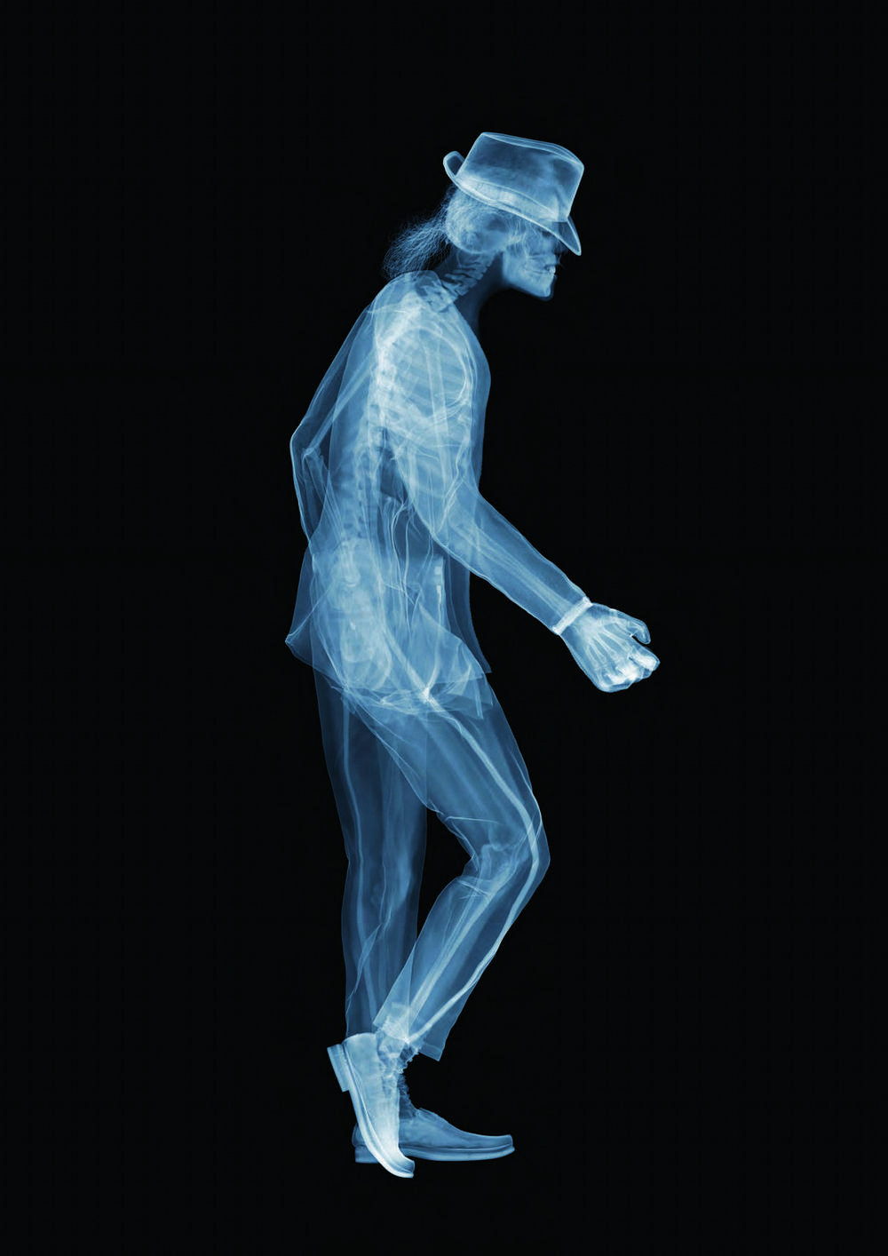 Удивительные рентгеновские фотографии Ника Визи