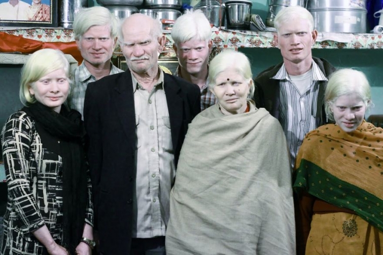 20 людей-альбиносов, поражающих своей внешностью