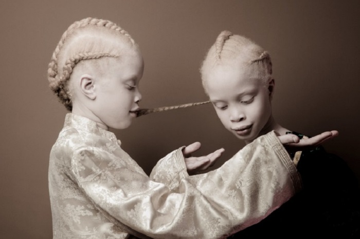 Эти близняшки покорили Интернет своей внешностью