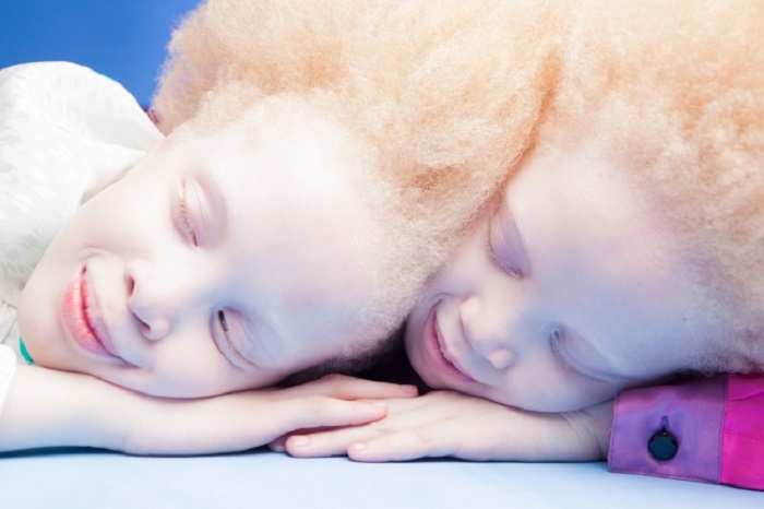 Эти близняшки покорили Интернет своей внешностью