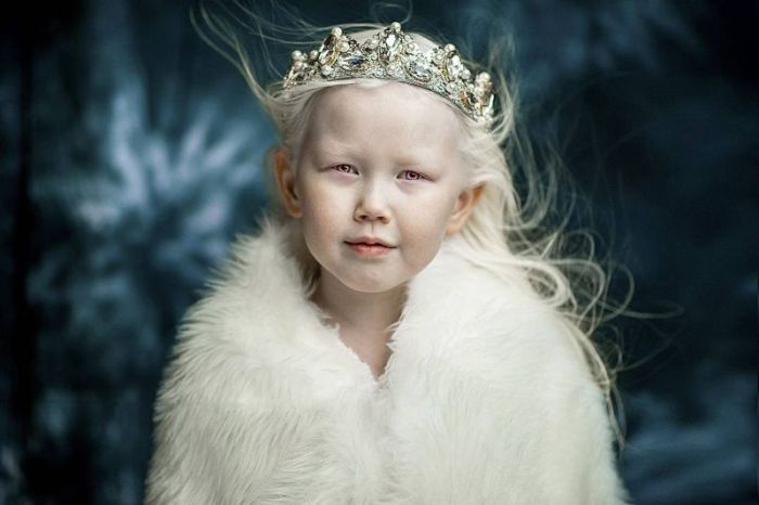 Якутскую девочку-альбиноса прозвали Снежной Королевой