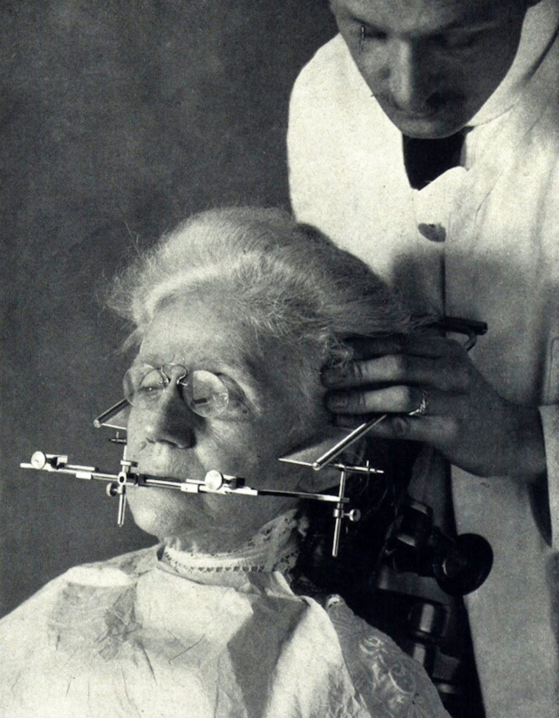 Жутковатые стоматологические снимки из прошлого