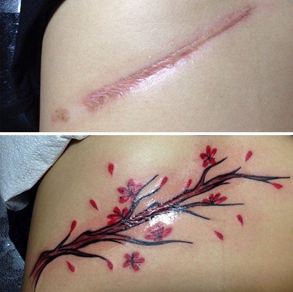 Татуировки, которые превращают шрамы в произведения искусства