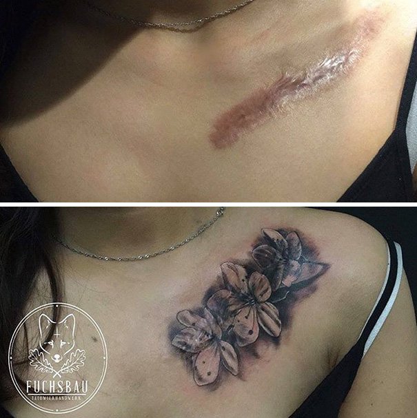 Татуировки, которые превращают шрамы в произведения искусства