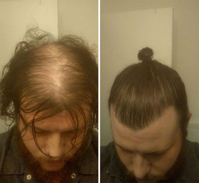 Как мужчине отрастить длинные волосы на голове у себя