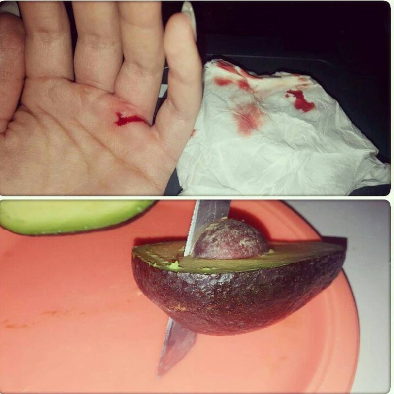 Ранение от авокадо - частая травма среди сторонников ЗОЖ