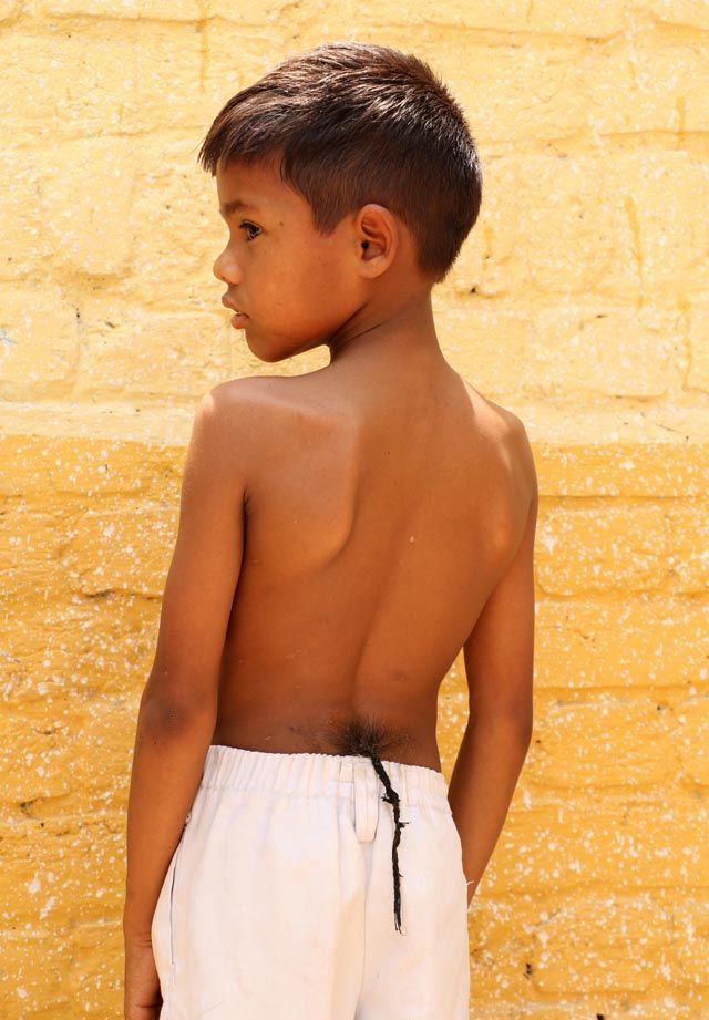 Индийского мальчика с хвостом называют богом-обезьяной