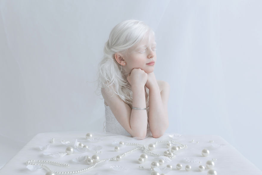 Фарфоровые люди-альбиносы в фотопроекте израильского фотографа