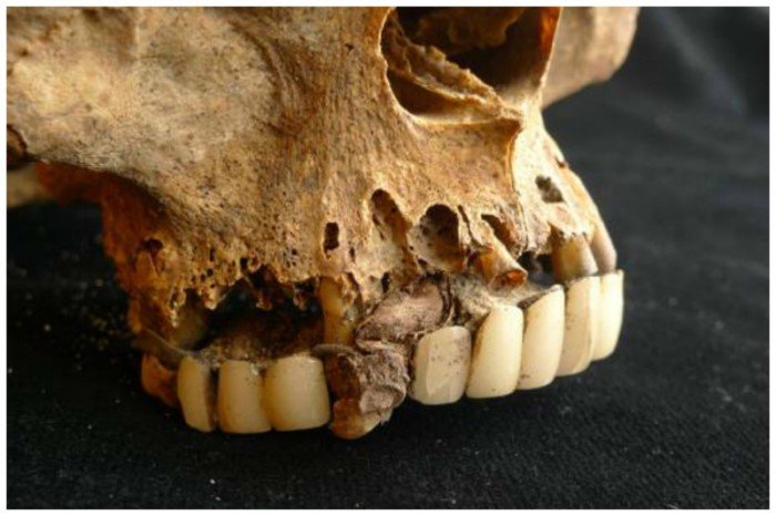 Что делали стоматологи прошлого