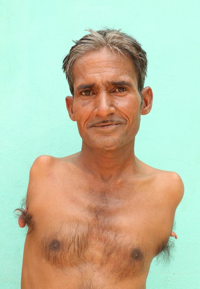 Индиец, родившийся без рук, стал профессиональным портным