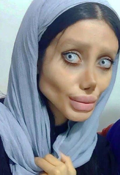 Иранка сделала 50 операций, чтобы быть похожей на Анджелину Джоли