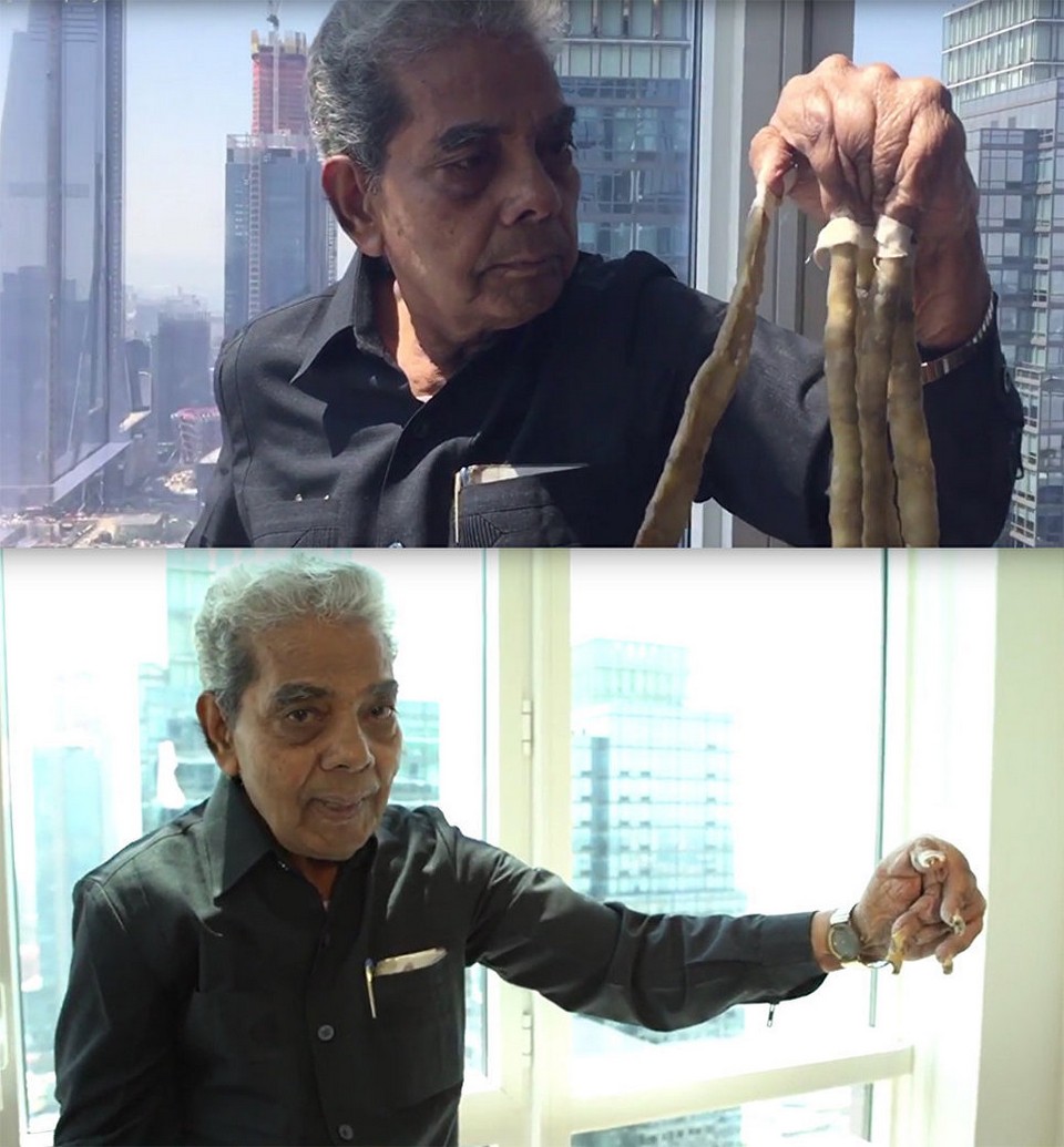 Индиец состриг ногти, которые отращивал 66 лет