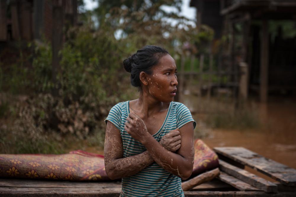 Последствия прорыва дамбы в Лаосе