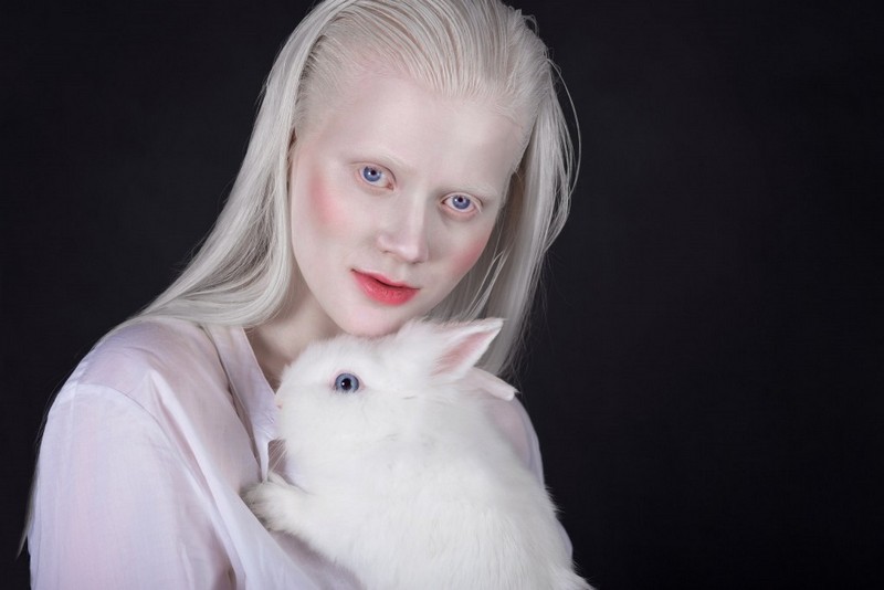 Интересные факты об альбиносах
