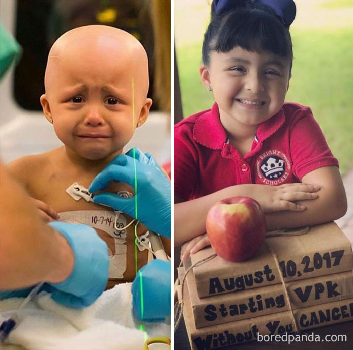 Люди, которые победили рак, на снимках до и после