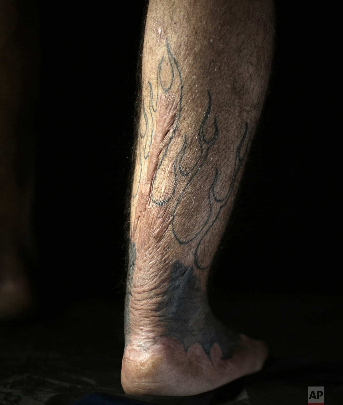 Иракцы делают татуировки, чтобы скрыть шрамы войны