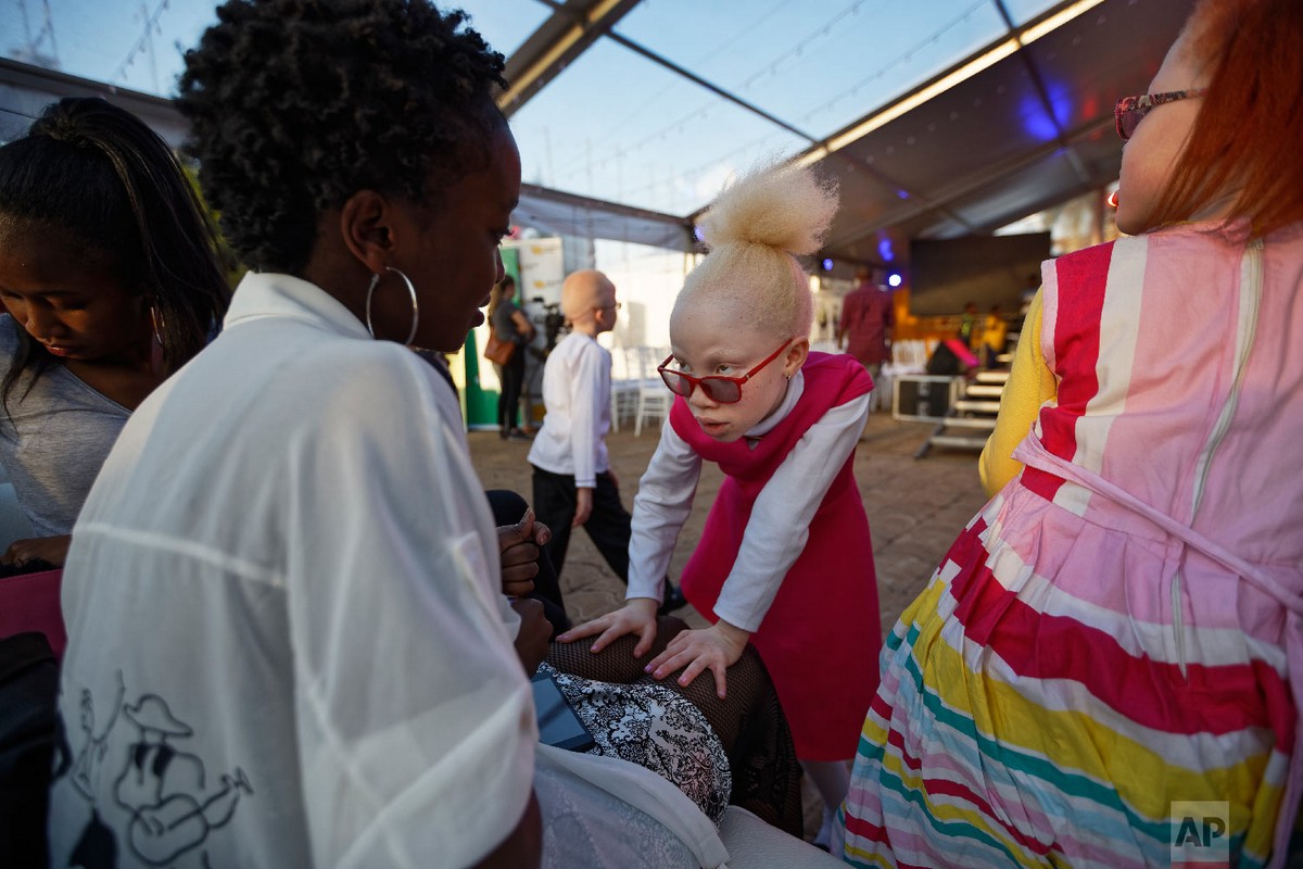 Конкурс красоты для людей с альбинизмом 2018