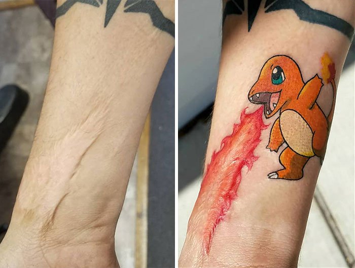 Креативные татуировки, которые скрывают шрамы