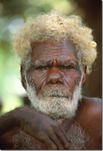 Каждый десятый темнокожий житель Меланезии — блондин