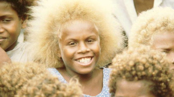 Каждый десятый темнокожий житель Меланезии — блондин